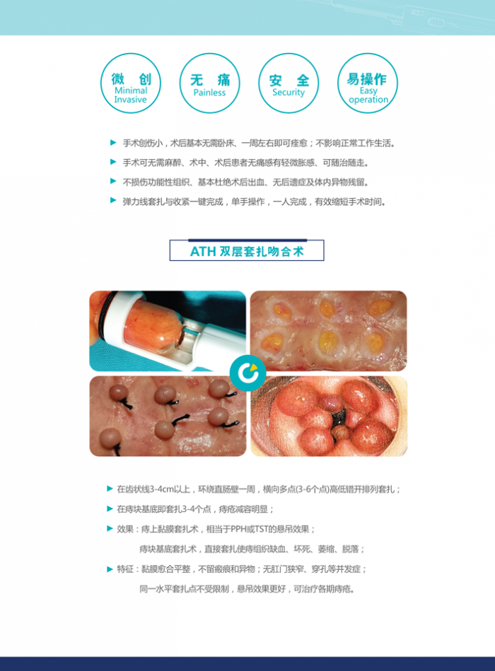 善謀善為 加快推進器械審評審批改革工作 ——國家藥監局召開專題會研究器械審評審批改革思路舉措  